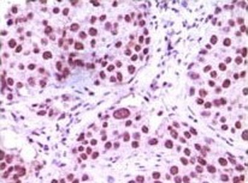 KDM1A Antibody