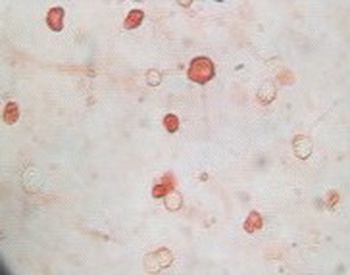 KSHVK8a Antibody [8C12G10G1]