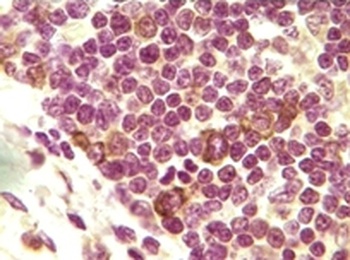 INHA Antibody