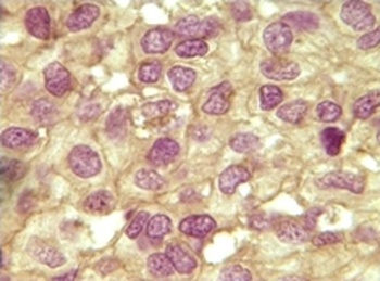 INHA Antibody