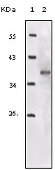 IGF1R Antibody