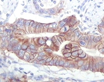 IGF1R Antibody