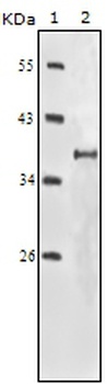 IGF1R Antibody