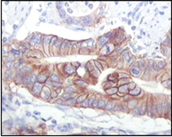 IGF1R Antibody