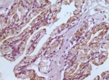 GSTP1 Antibody