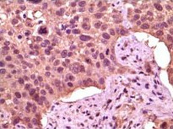 GSK3A Antibody