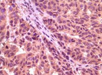 GSK3A Antibody