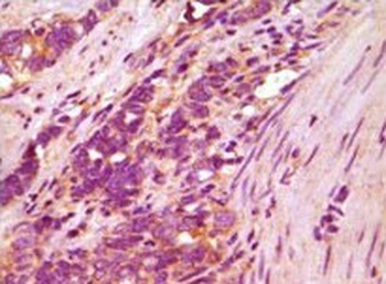 FBLN5 Antibody