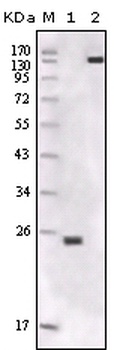 FER Antibody