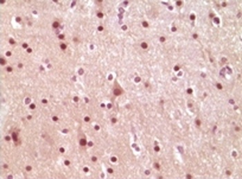 ELK1 Antibody