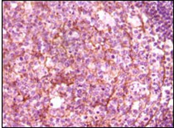 DNM1 Antibody