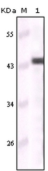 KRT5 Antibody