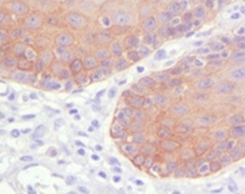 KRT5 Antibody