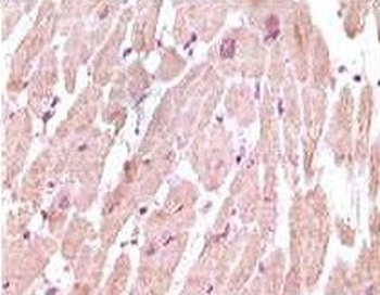 TNNI3 Antibody