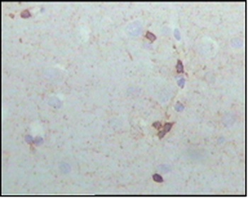 CRYAB Antibody