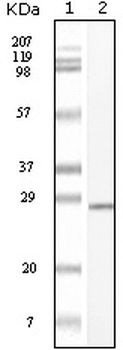 CKit Antibody [8D7B4 / 8D7D4 / 7H6B2 / 7H6B12]