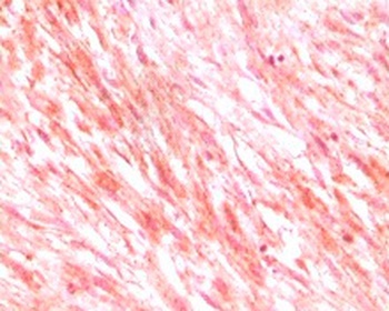 CKit Antibody [8D7B4 / 8D7D4 / 7H6B2 / 7H6B12]