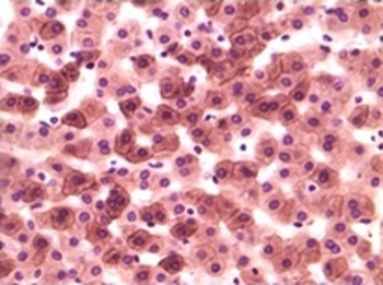 CSNK1A1 Antibody