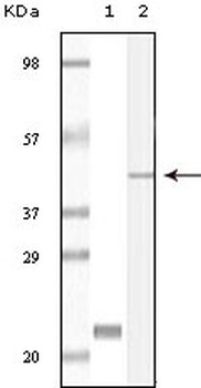 CIB1 Antibody [5A1F5E12 / 5A1H7E12]