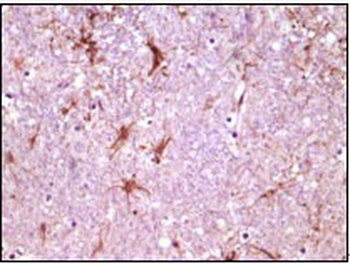 CIB1 Antibody [5A1F5E12 / 5A1H7E12]