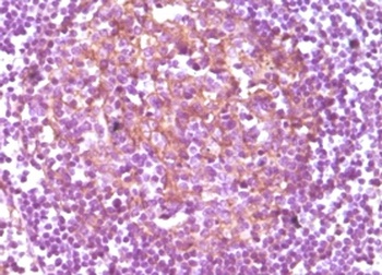 CD14 Antibody