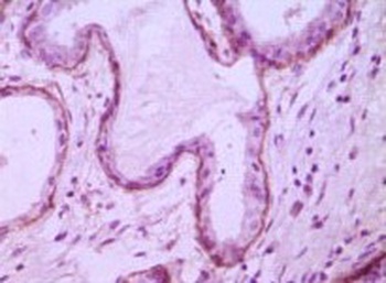 MME Antibody