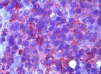 MME Antibody