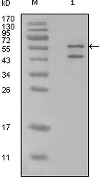 CALR Antibody