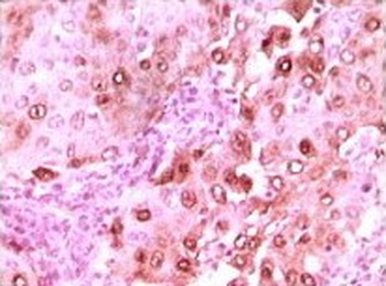 CACYBP Antibody