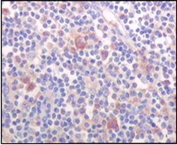 BTK Antibody
