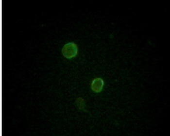 APOM Antibody