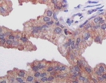 AMACR Antibody