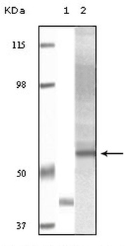 Akt3 Antibody [3B12F3F10 / 2D2B11B11 / 2D2B11H5]