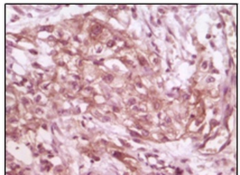 EIF4EBP1 Antibody