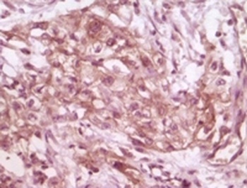 EIF4EBP1 Antibody