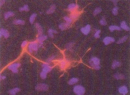 GFAP Antibody