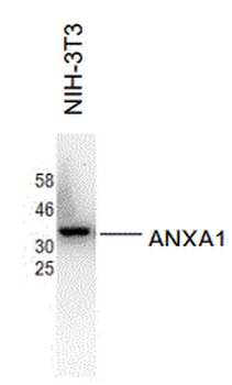 ANXA1 Antibody [E11]