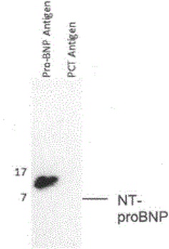 NPPB Antibody