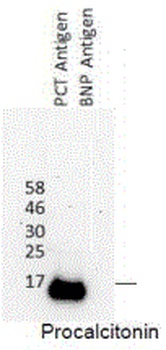 CALCA Antibody
