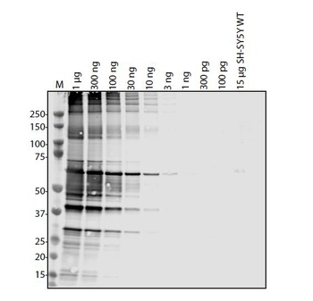 SARS-CoV-2 (COVID-19) Membrane Antibody