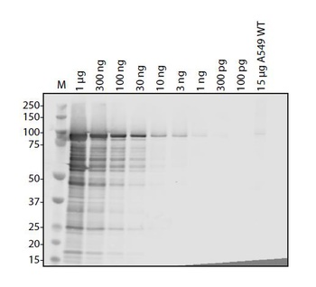 Human Coronavirus 229E Nucleocapsid Antibody