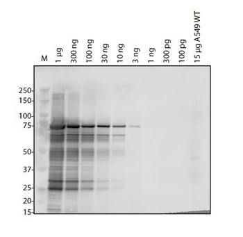 Human Coronavirus OC43 Nucleocapsid Antibody