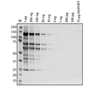 SARS-CoV-2 (COVID-19) NSP11 NSP12 Antibody