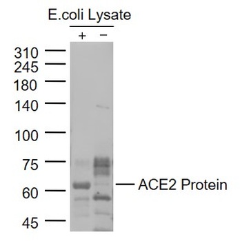 ACE2 Antibody