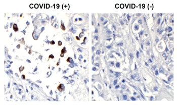 SARS-CoV-2 (COVID-19) Spike S1 Antibody [SP185]