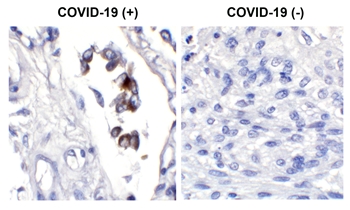 SARS-CoV-2 (COVID-19) Spike S1 Antibody [SP422]