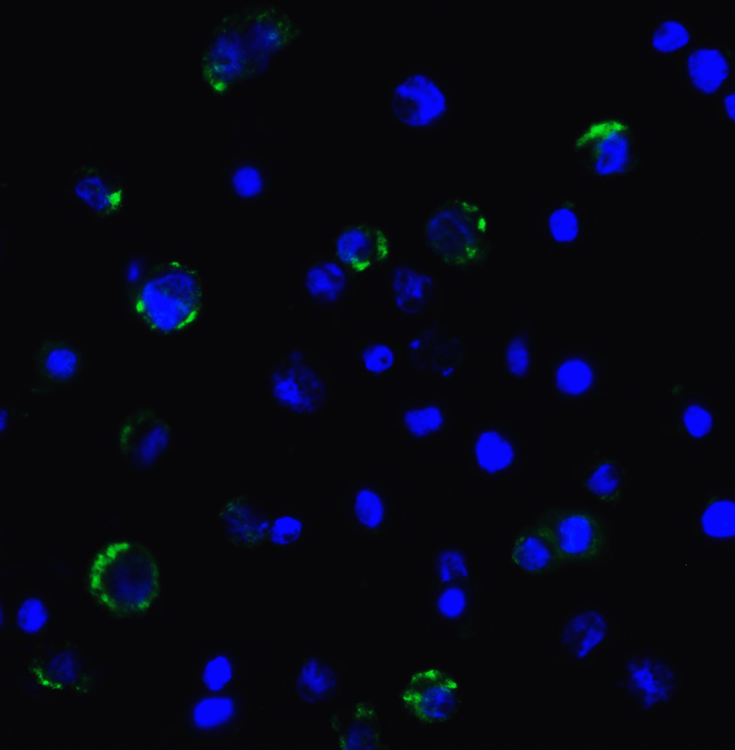 LAG-3 Single Domain Antibody [2A11]