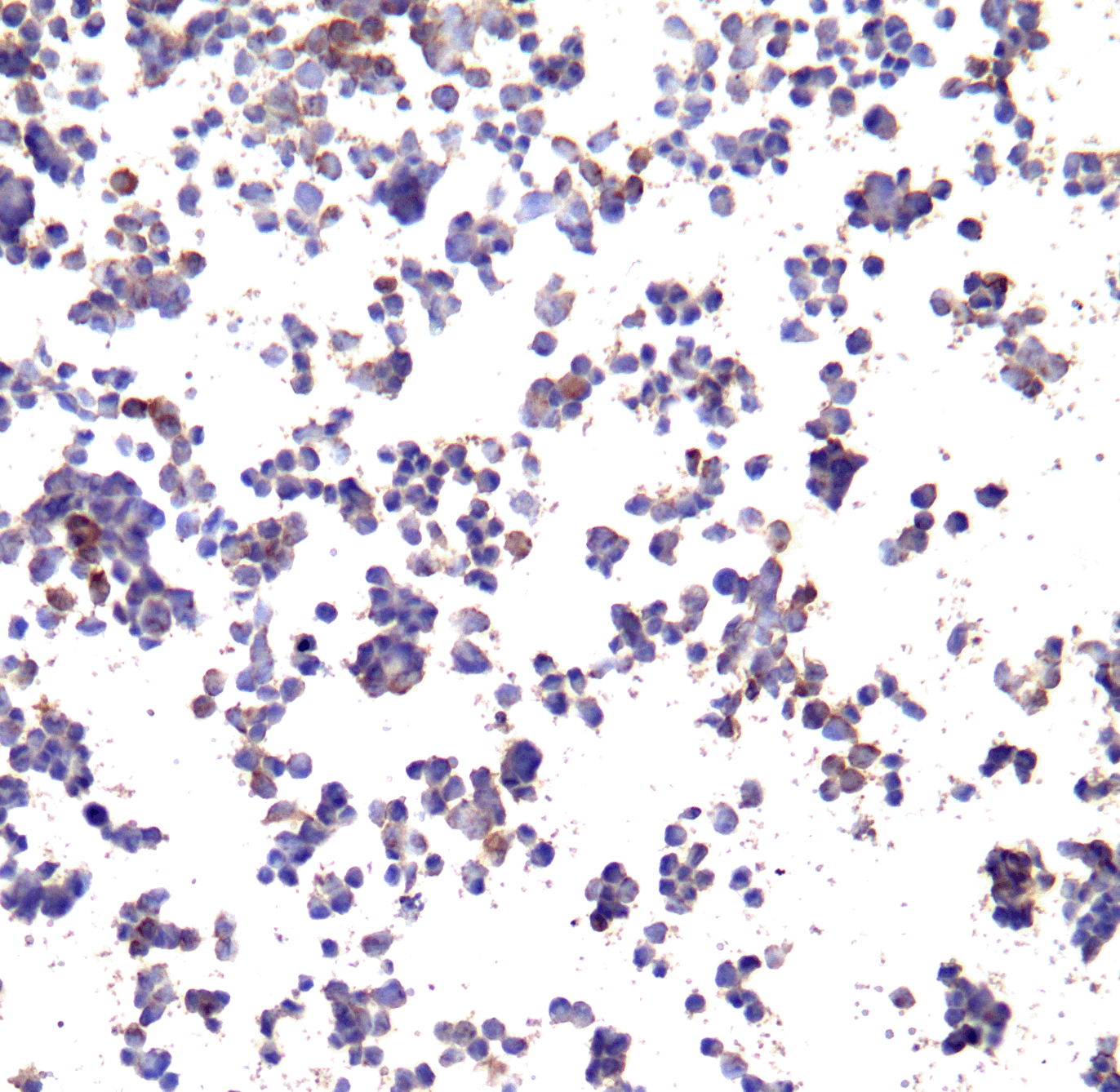 PD-L1 Single Domain Antibody [F6A9]