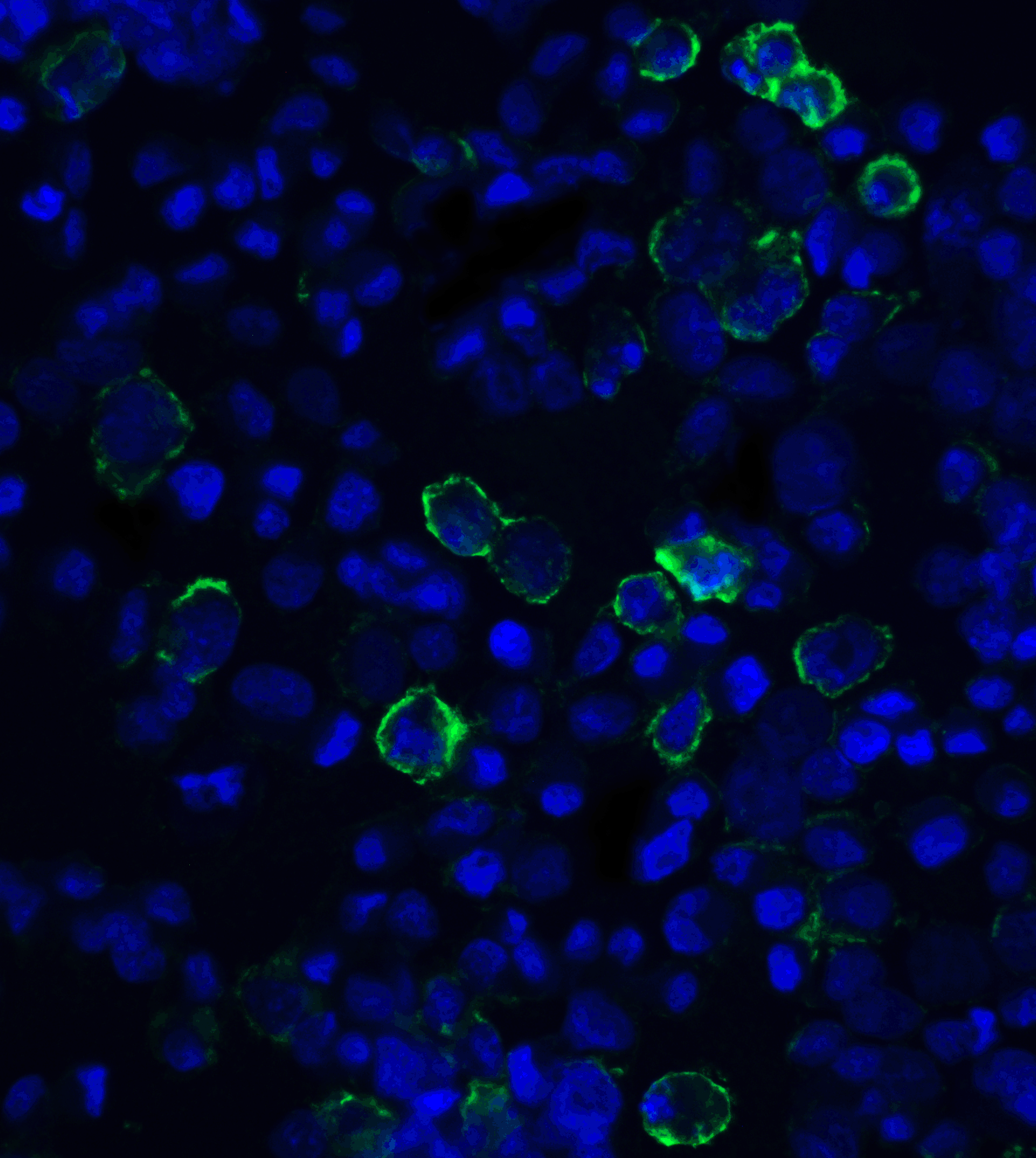 PD-L1 Single Domain Antibody [F2G2]