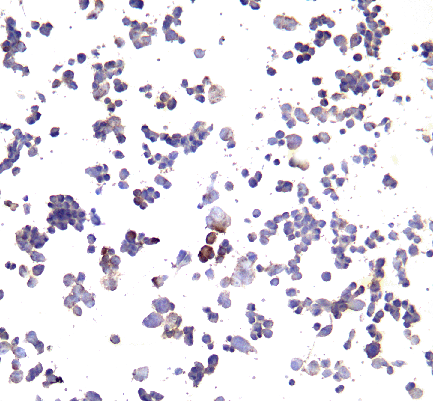 PD-L1 Single Domain Antibody [F2G2]